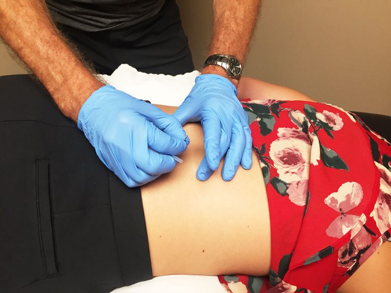 Relief Ridge Gunn IMS Physiotherapy in Maple Ridge & Pitt Meadows | Chronic Pain Relief